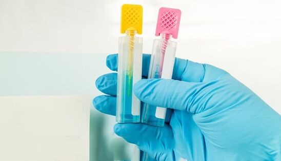 Parazita diagnosztikai módszerek