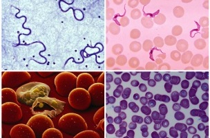 milyen paraziták lehetnek az emberi vérben