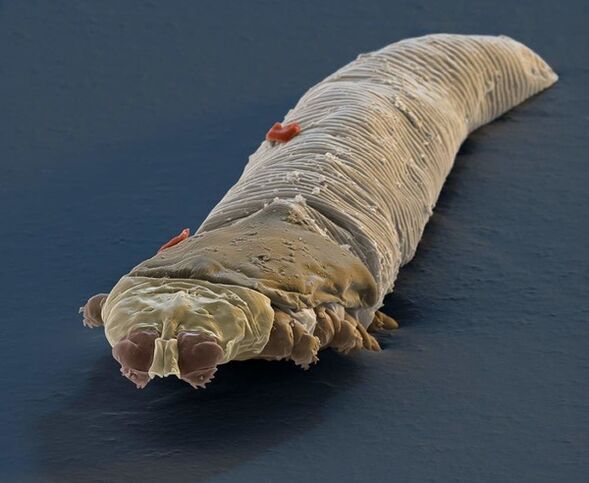 a parazita bejut a bőrbe
